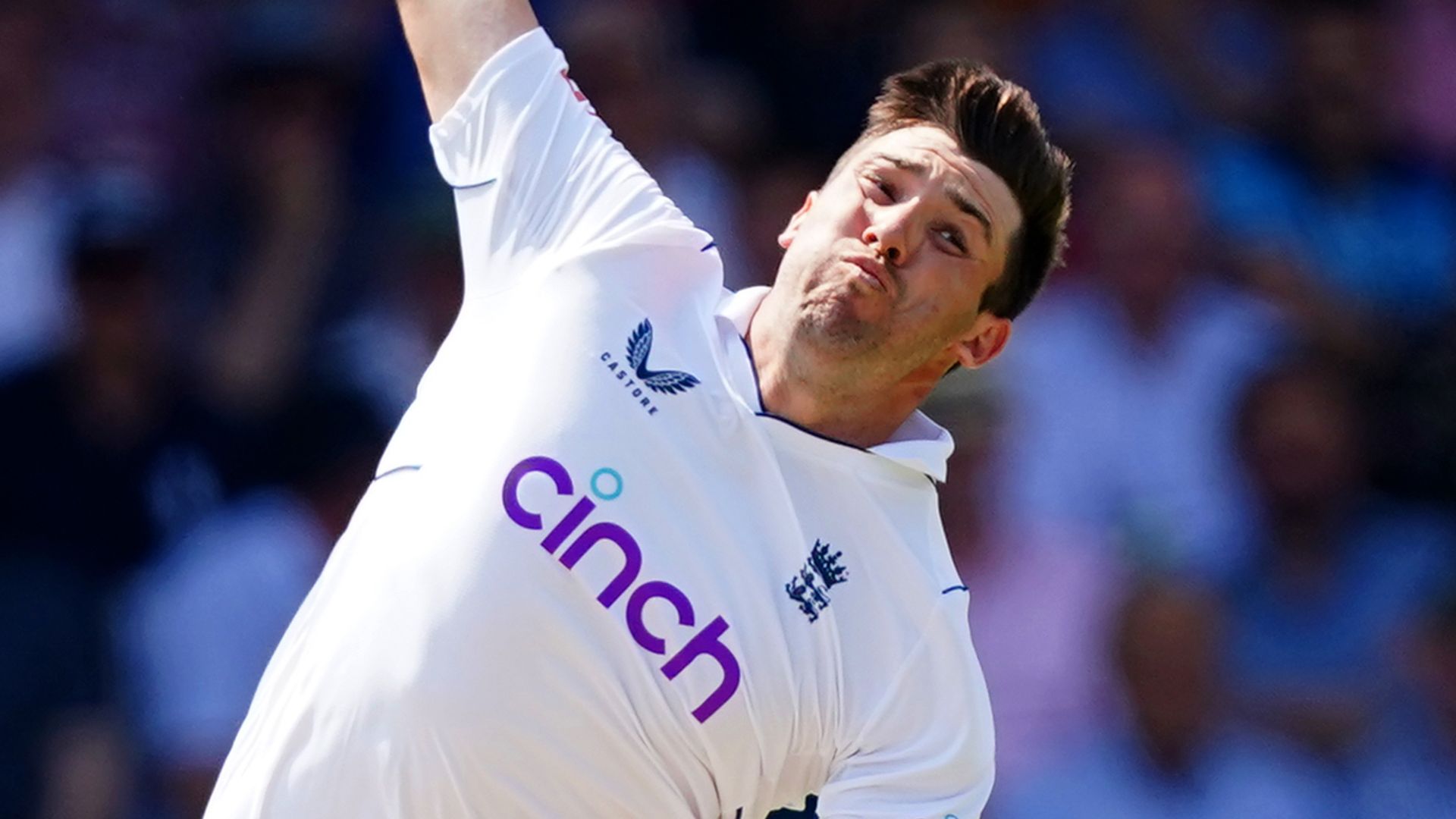 England sweat on Overton fitness after stress fracture diagnosis