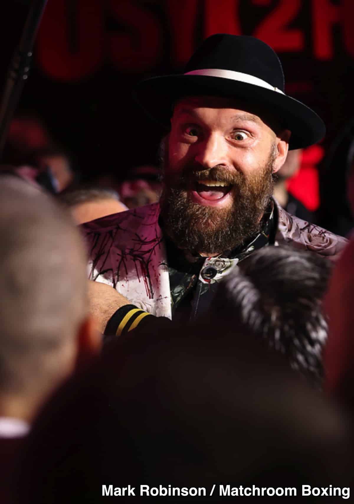 Tyson Fury’s Path to $500 Million: Can He Reignite His Career?